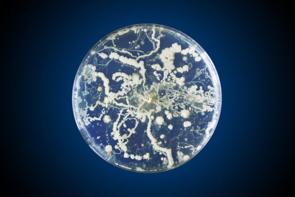 Bacteria growing in a petri dish