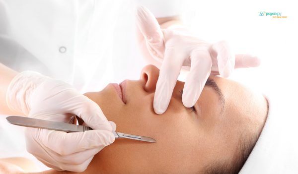 La técnica del dermaplaning, cada vez más en auge.