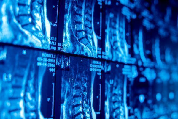 Medical equipment. MRI picture. Background