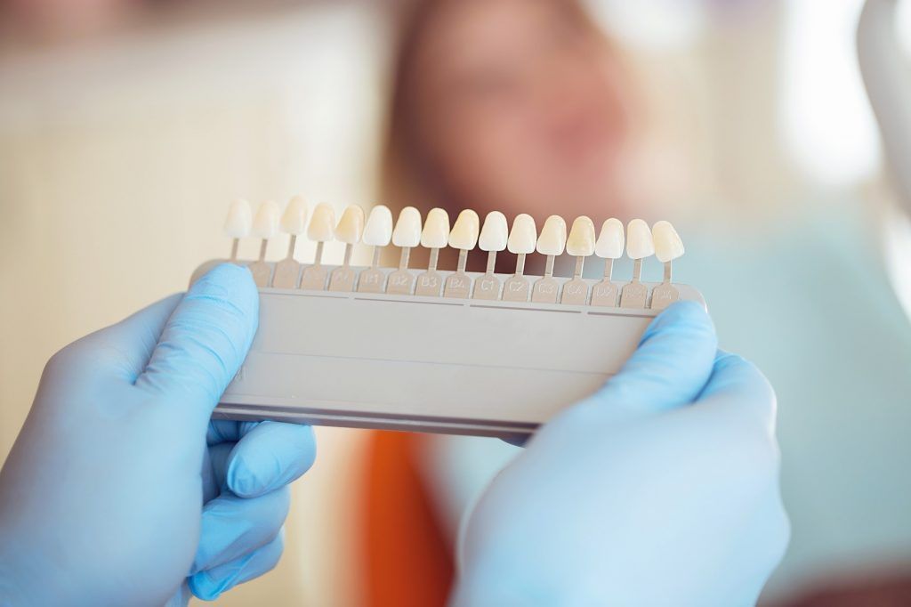 Procesos y productos para blanquear los dientes