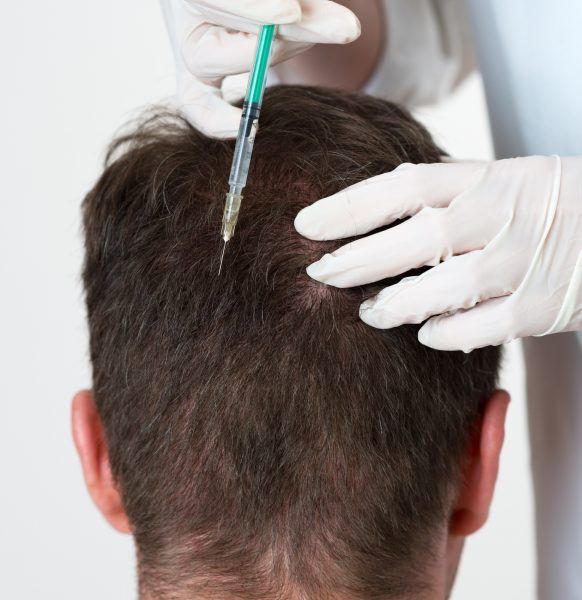 Handsome man is getting injection in head. Concept of Mesotherapy.