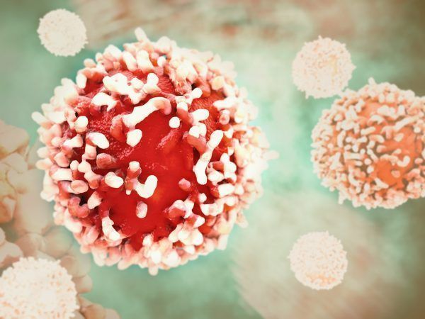 Cancer cell in human body