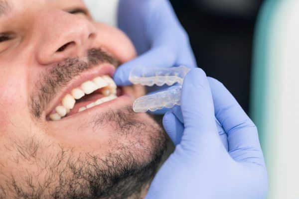 Smiling male patient trying invisible braces