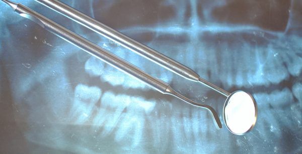 Dental tools lying on the x-ray .